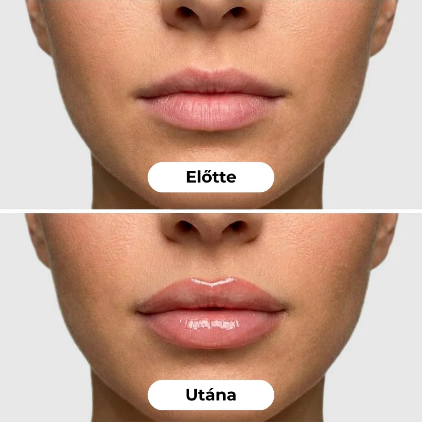 NovaStella Luxe Plump